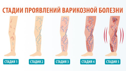6d8cdaba-ace7-4773-8f55-e94855fd4ab1_thumb500.jpg