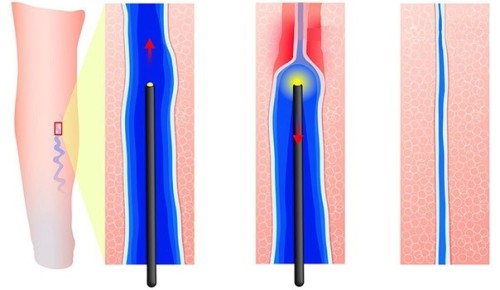 60fefd2b-dd11-437a-83b1-9c89df715ecf_thumb500.jpg