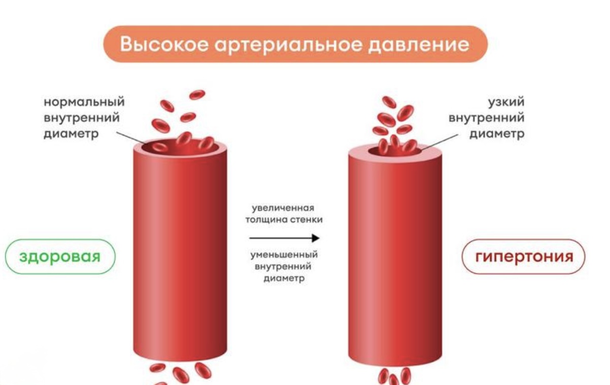 ab98743f-5937-46ea-a4de-97449d5bfb97.jpeg