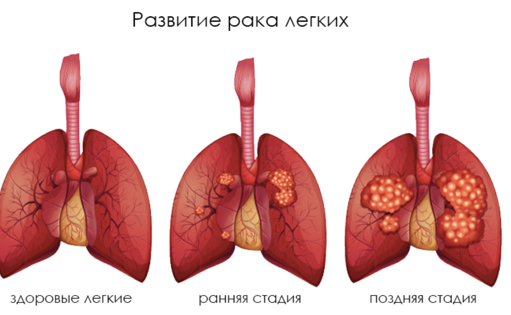 90c15ad0-2af7-44e1-9fd1-083693fd3692.png