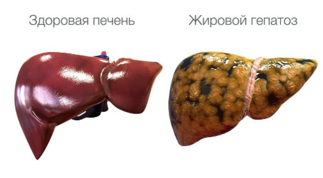 8d95026a-a36b-4d4f-b31b-bfa9da9a8bfb.png